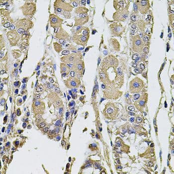 Polyclonal Rabbit anti-Human PTHLH / PTHRP Antibody (IHC, WB)