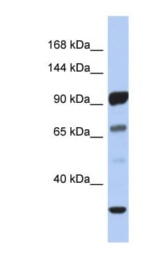 Polyclonal Rabbit anti-Human PCDHA10 Antibody (aa143-192, WB)