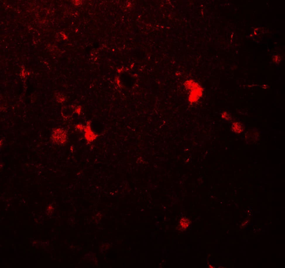 IHC-plus™ Polyclonal Rabbit anti-Human ULK3 Antibody (IHC, IF, WB)