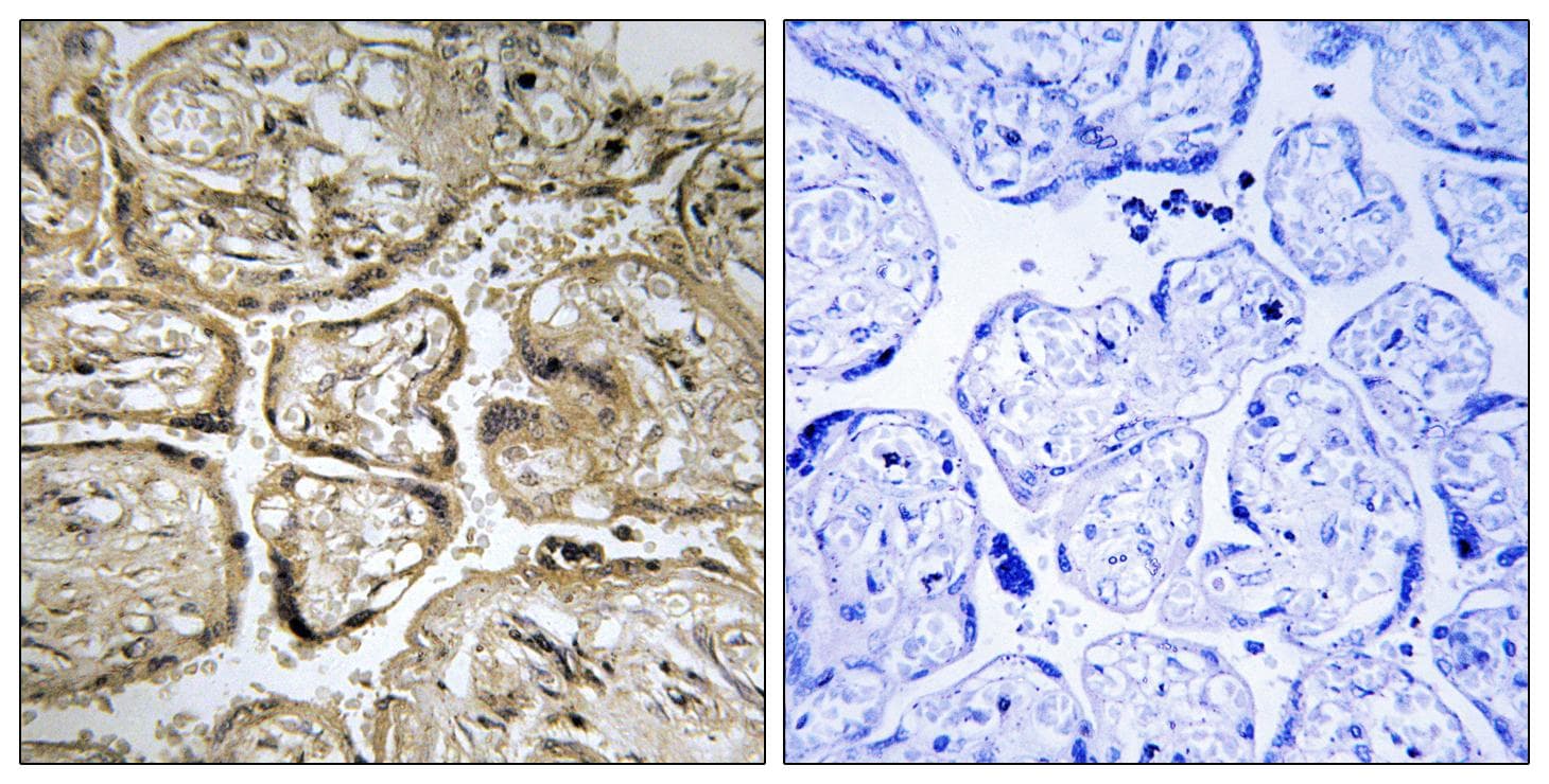 Polyclonal Rabbit anti-Human CST9L / Cystatin 9-Like Antibody (IHC)