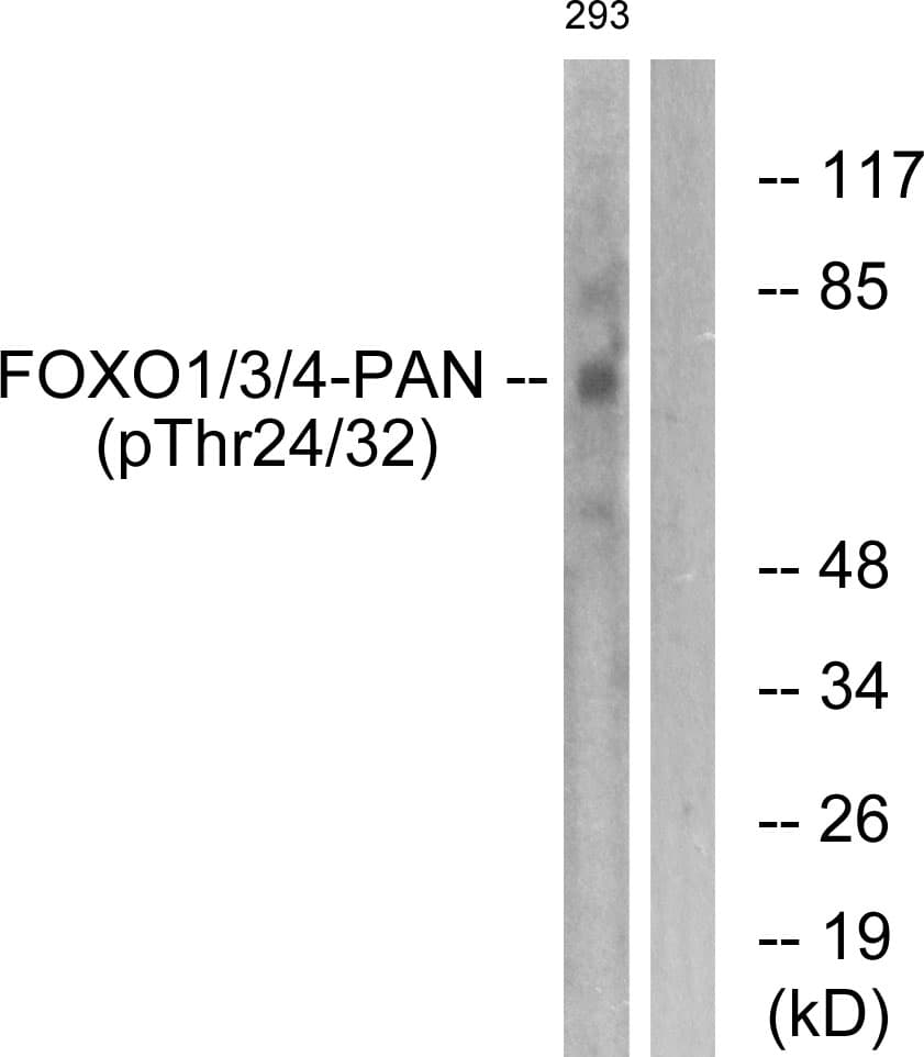 FOXO1+3+4 Antibody (phospho-Thr24/Thr32)