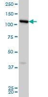 CCDC132 Antibody (clone 2D11)