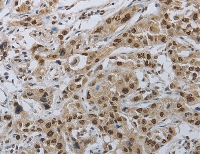PRKAR1B Antibody