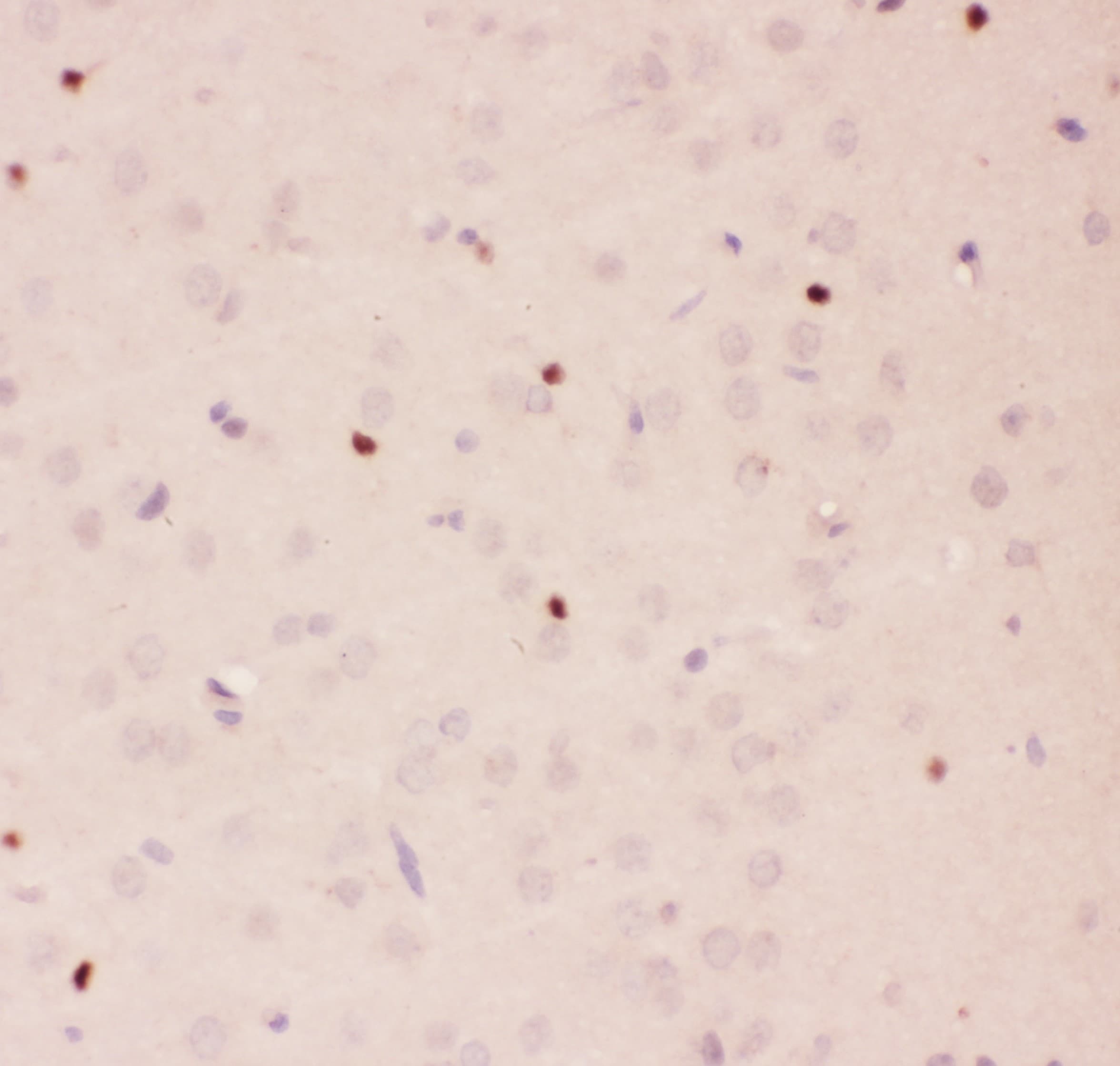 APEX1 / APE1 Antibody (aa2-318)