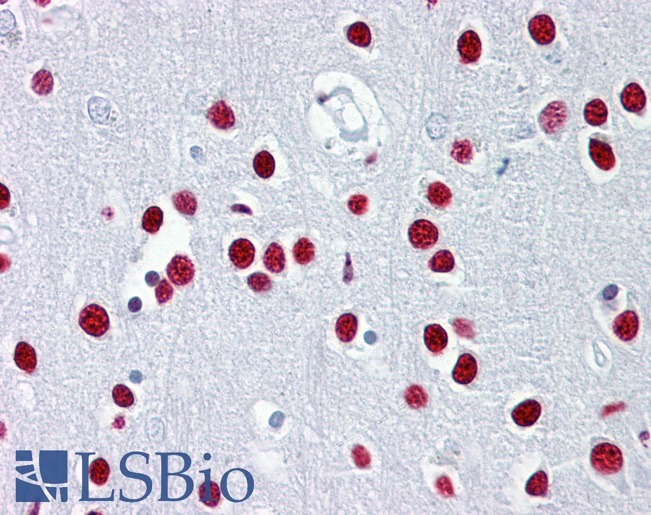 Polyclonal Rabbit anti-Human TUB / Tubby Antibody (aa144-193, IHC, WB)