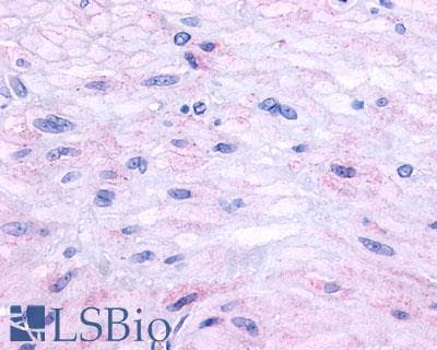 PathPlus™ TACR2 / NK2R Antibody (C-Terminus)