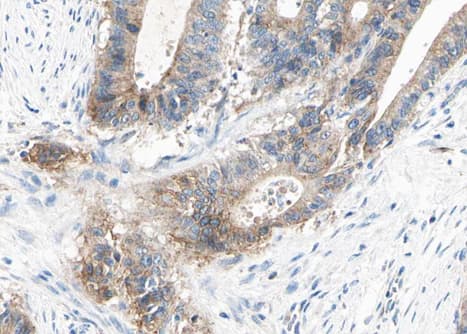 ACTN2 Antibody