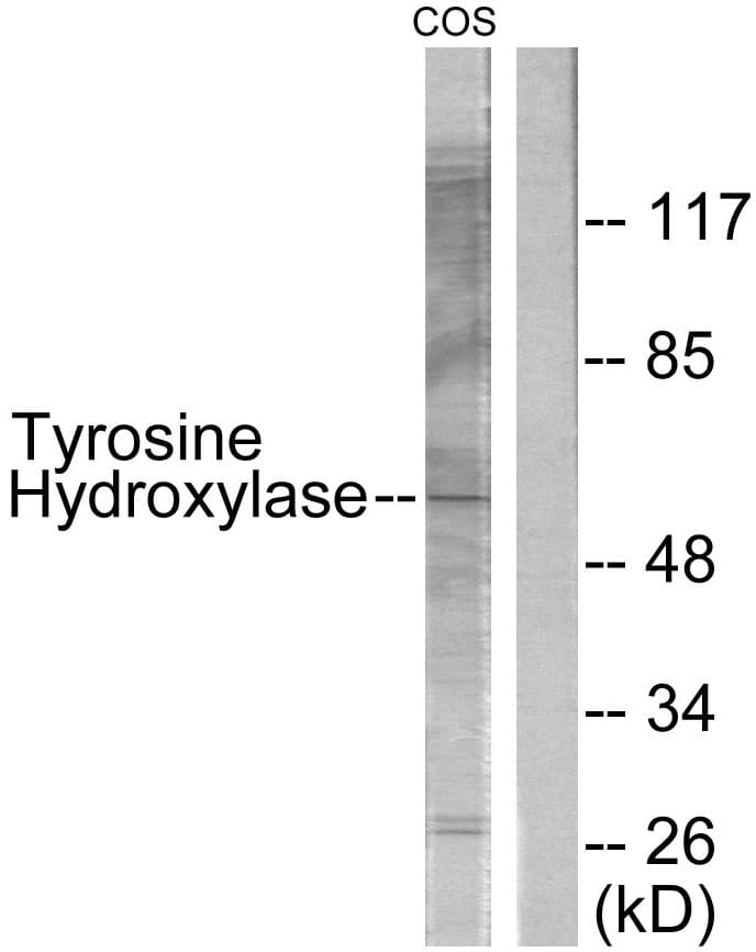 TH / Tyrosine Hydroxylase Antibody (aa1-50)
