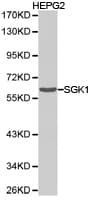 Polyclonal Rabbit anti-Human SGK1 / SGK Antibody (IHC, WB)