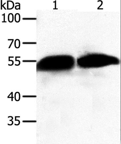 GC / Vitamin D-Binding Protein Antibody