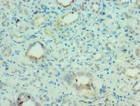 Polyclonal Rabbit anti-Human MLANA / Melan-A Antibody (aa48-118, IHC)