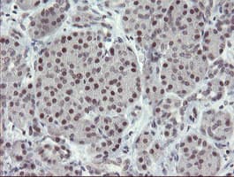 ZBED1 / TRAMP Antibody (clone OTI5A2)
