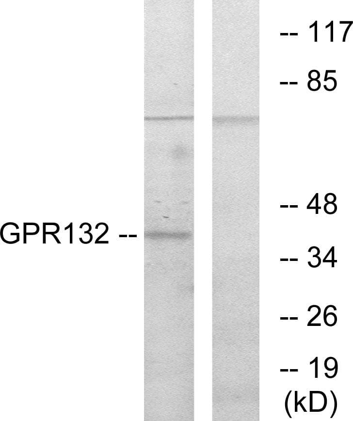 GPR132 / G2A Antibody