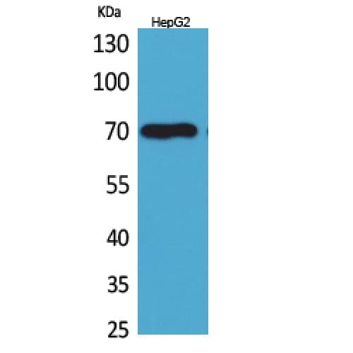 Polyclonal Rabbit anti-Human GPC3 / Glypican 3 Antibody (Internal, WB)