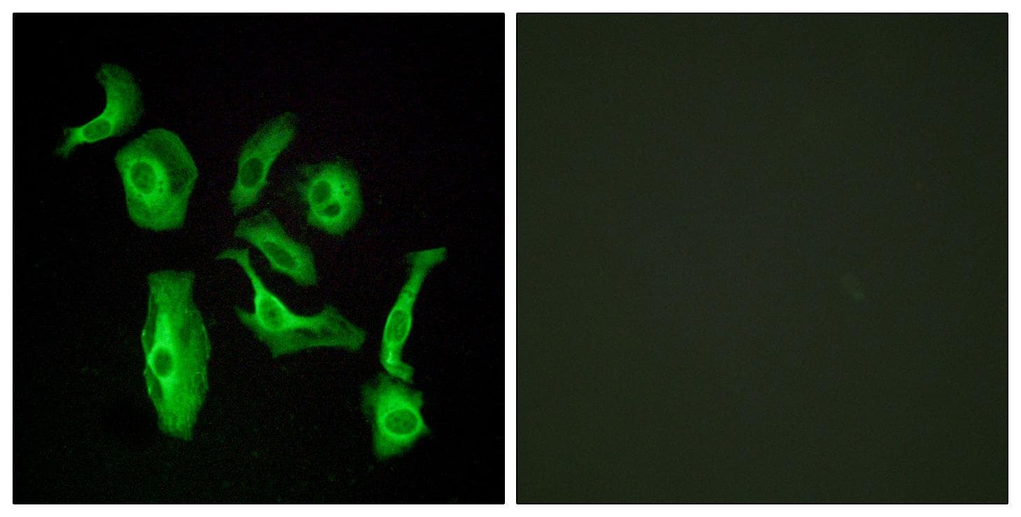 ADGRD1 / GPR133 Antibody