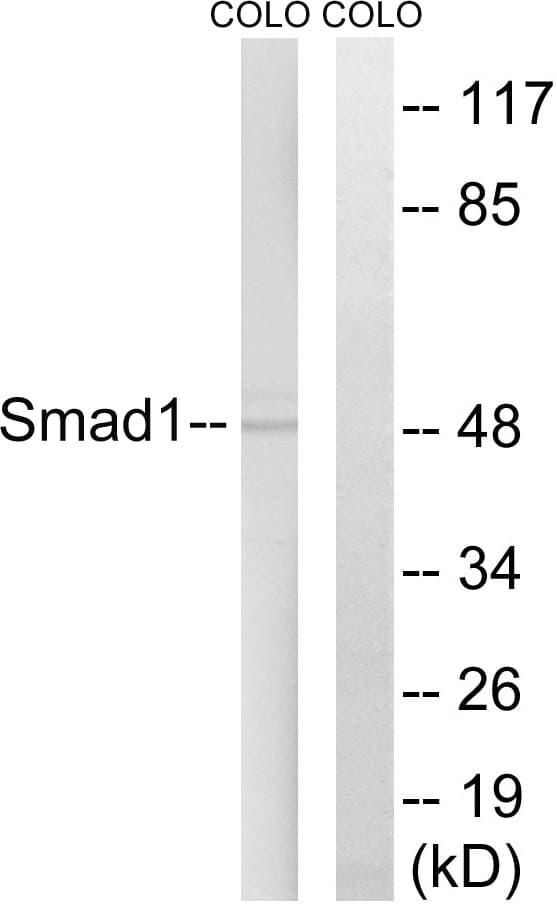 Polyclonal Rabbit anti-Human SMAD1 Antibody (aa416-465, IHC, WB)