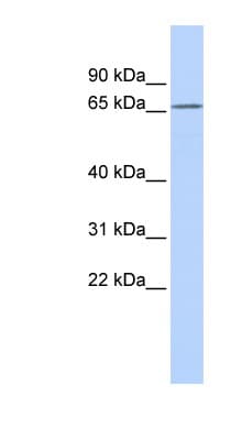 K13 / KCNG Antibody (aa108-157)