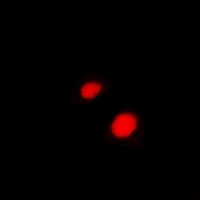 LHX6 Antibody