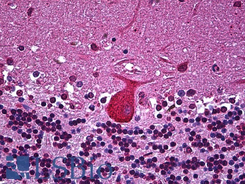 IHC-plus™ TNF Alpha Antibody (clone M 1 C4)