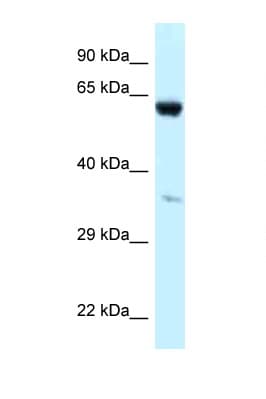 P4HA1 Antibody (aa228-277)