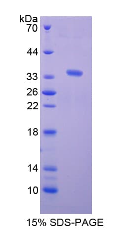 Rat C1qRP / CD93 Protein (Recombinant His-T7)