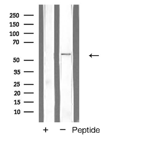 GCGR / Glucagon Receptor Antibody