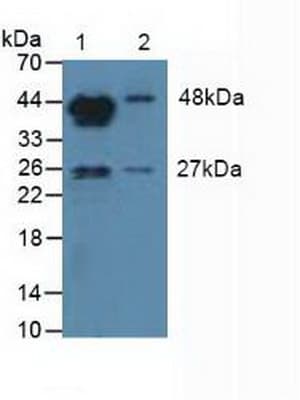 CYP19 / Aromatase Antibody (aa196-373)