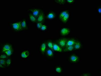 TTN / Titin Antibody (aa5398-5604)