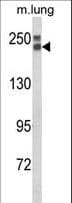 Polyclonal Rabbit anti-Human Endostatin Antibody (aa237-263, WB)