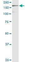 Monoclonal Mouse anti-Human EIF3A Antibody (clone 2G4, WB)