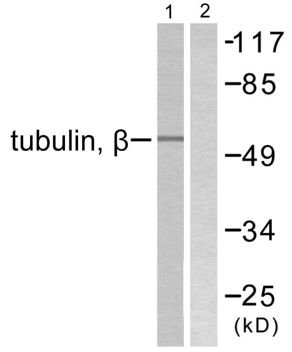 Polyclonal Rabbit anti-Human Beta Tubulin Antibody (IHC, WB)