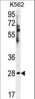 Polyclonal Rabbit anti-Human HSD11B1L Antibody (aa256-283, IHC, IF, WB)