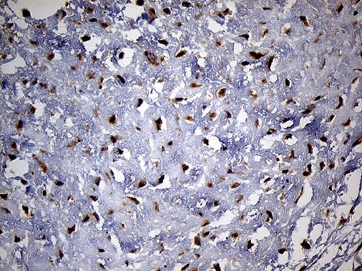 PYGM Antibody (aa698-842, clone OTI3F9)