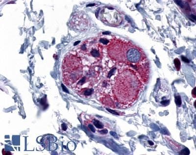 PathPlus™ Polyclonal Rabbit anti-Human PTGER4 / EP4 Antibody (C-Terminus, IHC)