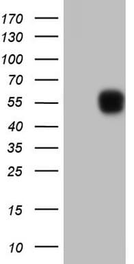 SETD2 Antibody (aa1787-2144, clone OTI1C4)