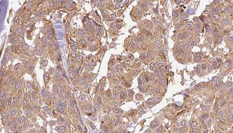 Polyclonal Rabbit anti-Human KLHL3 Antibody (IHC, IF, WB)