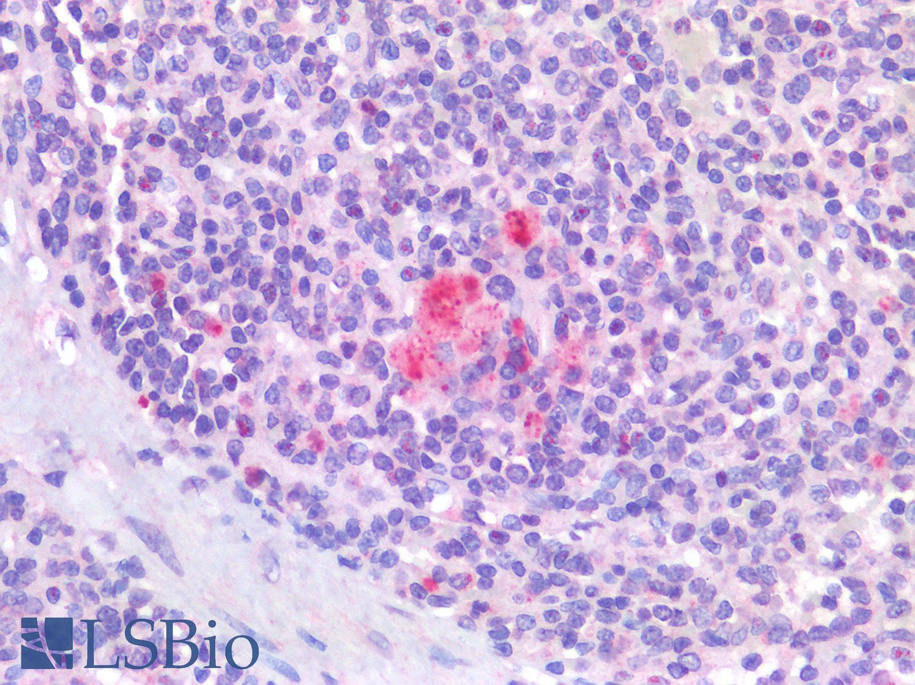 IHC-plus™ IL4 Antibody