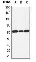 EIF2AK2 / PKR Antibody (phospho-Thr451)