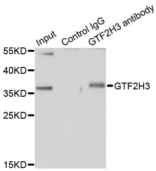 Polyclonal Rabbit anti-Human GTF2H3 Antibody (IHC, IF, WB)