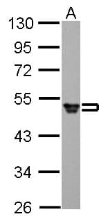 IHC-plus™ Polyclonal Rabbit anti-Human FGG / Fibrinogen Gamma Antibody (Internal, IHC, WB)