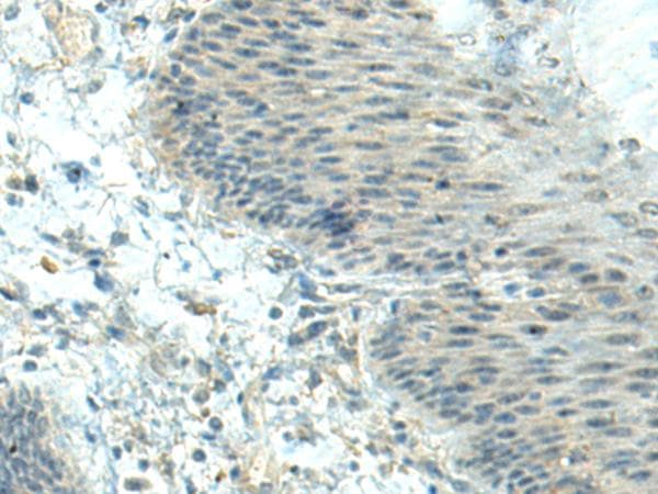 Polyclonal Rabbit anti-Human CTDP1 / FCP1 Antibody (IHC)