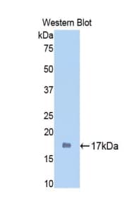 SIRT7 / Sirtuin 7 Antibody (aa135-274, Cy3)