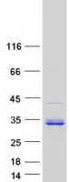 Human CHTOP / FOP Protein (Recombinant Myc-DDK (Flag))