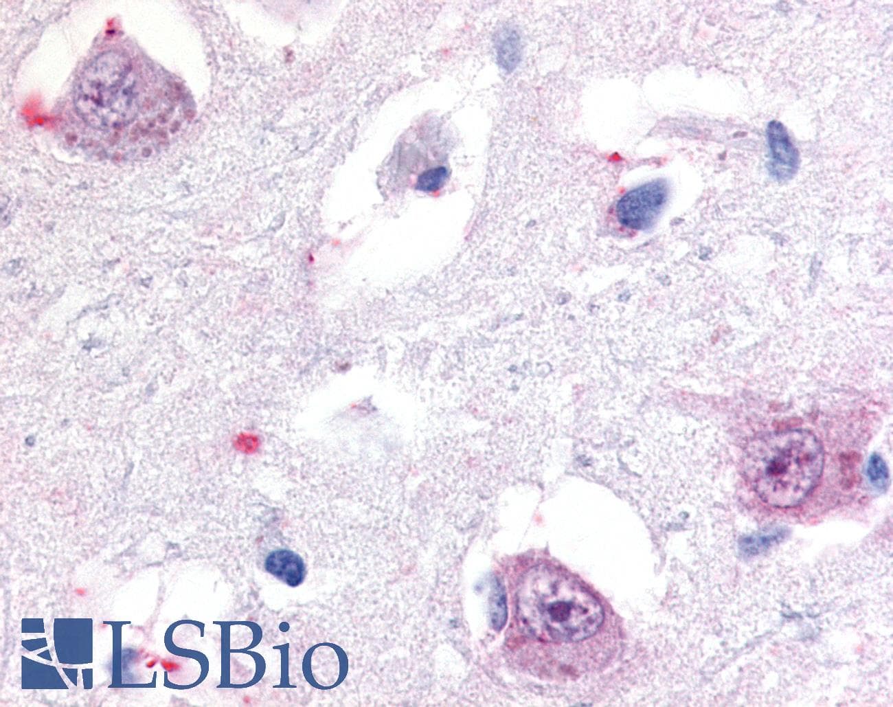 PathPlus™ RORB / ROR Beta Antibody (Hinge Domain)