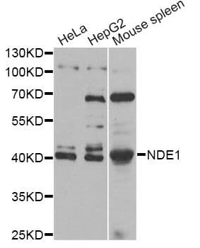 Polyclonal Rabbit anti-Human NDE1 Antibody (IF, WB)