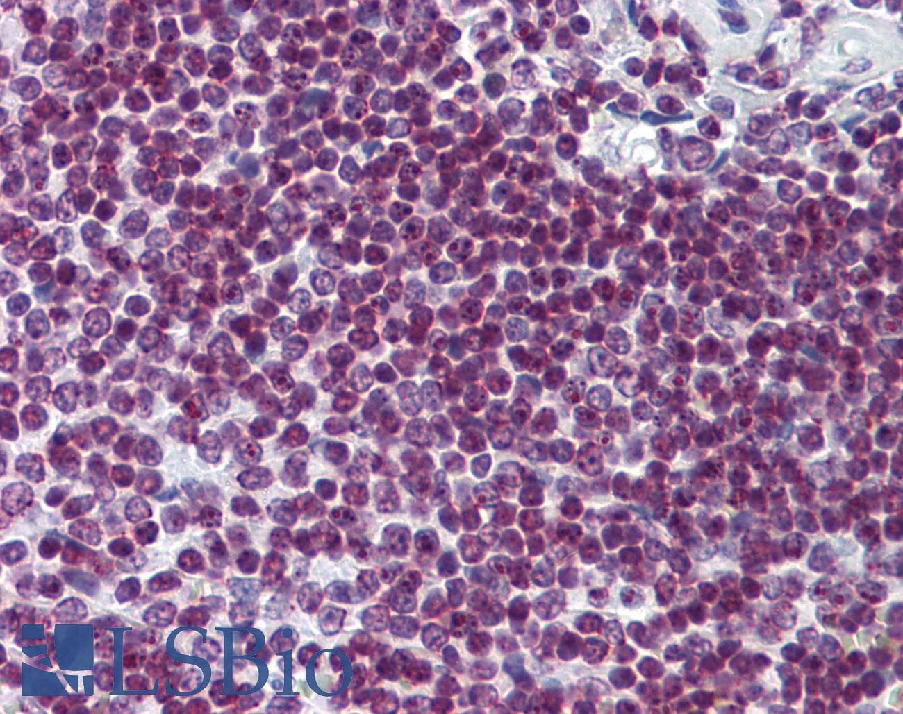 IHC-plus™ Monoclonal Mouse anti-Human FOXO3 / FOXO3A Antibody (clone 2C5, IHC, IF, WB)