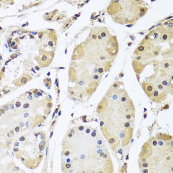 HNRNPL / hnRNP L Antibody