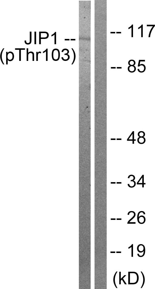 Polyclonal Rabbit anti-Human MAPK8IP1 / JIP1 Antibody (phospho-Thr103, IF, WB)