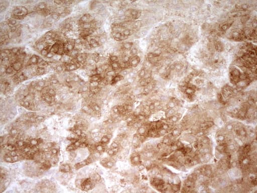 Zfp105 / ZNF35 Antibody (aa1-258, clone OTI3H5)