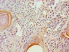 Polyclonal Rabbit anti-Human GAD1 / GAD67 Antibody (aa1-200, IHC, WB)